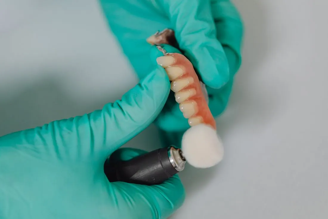 Cầu Răng Sứ Và Implant Hoạt Động Như Thế Nào?