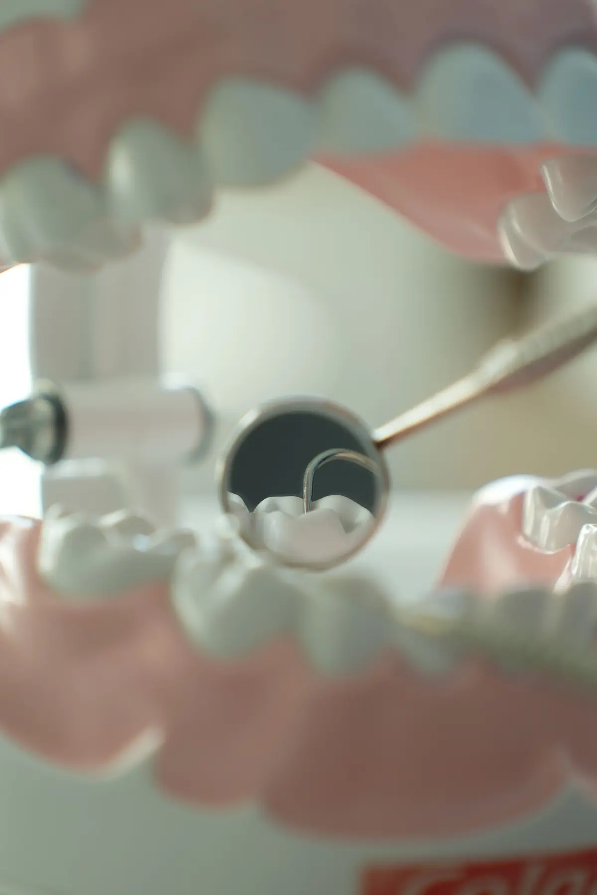 Bảng so sánh chi phí Implant vs hàm giả