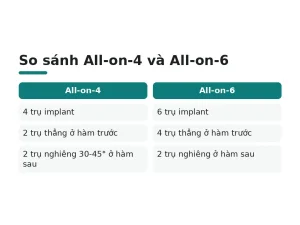 So sánh All-on-4 và All-on-6