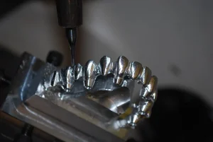 dental bridge sensitivity