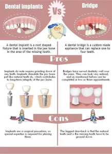 porcelain crown implant