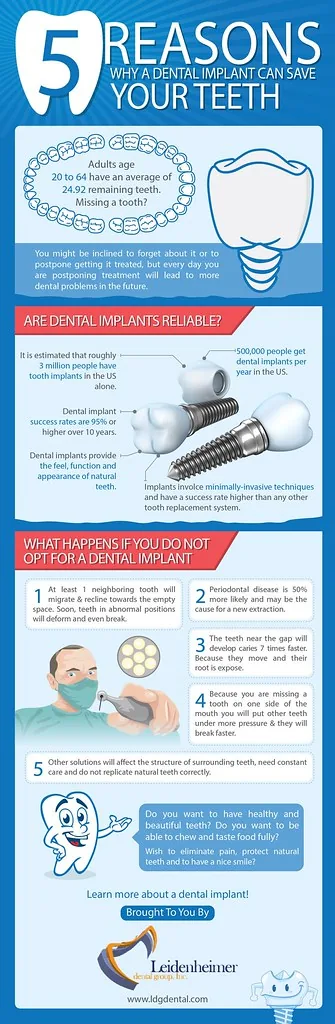 Porcelain fused metal crown durability