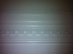 dental crown fell off porcelain loose