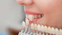 Bọc ở Nhật hay Việt Nam phù hợp hơn?