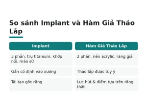 So sánh Implant và Hàm Giả Tháo Lắp