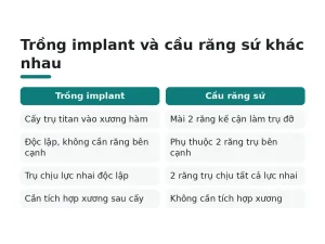 Trồng implant và cầu răng sứ khác nhau