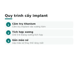 Quy trình cấy implant