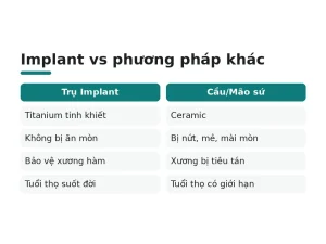 Implant vs phương pháp khác
